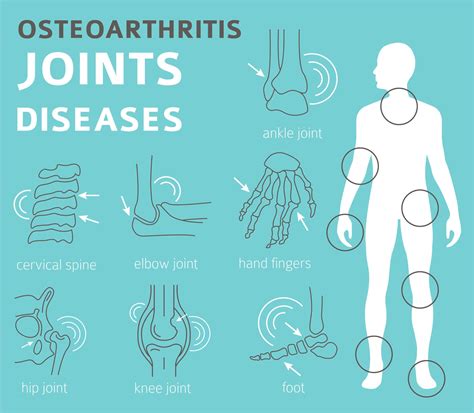 is osteoarthritis a physical disability.